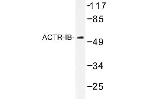 Image no. 1 for anti-Activin A Receptor, Type IB (ACVR1B) antibody (ABIN272185) (Activin A Receptor Type IB/ALK-4 Antikörper)