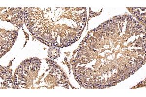 Detection of HK1 in Rat Testis Tissue using Polyclonal Antibody to Hexokinase 1 (HK1) (Hexokinase 1 Antikörper  (AA 80-215))