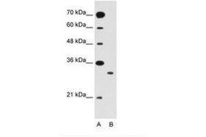 Image no. 2 for anti-Solute Carrier Family 25 (Mitochondrial Carrier: Glutamate), Member 22 (SLC25A22) (AA 131-180) antibody (ABIN205021)