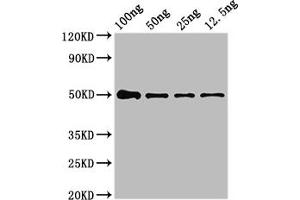 Western Blot Positive WB detected in Recombinant protein All lanes: NIPBL antibody at 4 μg/mL Secondary Goat polyclonal to rabbit IgG at 1/50000 dilution predicted band size: 50 kDa observed band size: 50 kDa (NIPBL Antikörper  (AA 2523-2697))