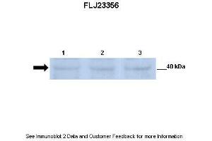 Lanes:   Lane 1: 30ug mouse renal epithelial lysate Lane 2: 30ug mouse renal epithelial lysate Lane 3: 30ug mouse renal epithelial lysate  Primary Antibody Dilution:   1:500  Secondary Antibody:   Anti-rabbit-HRP  Secondary Antibody Dilution:   1:2500  Gene Name:   FLJ23356  Submitted by:   Dr. (SGK196 Antikörper  (N-Term))