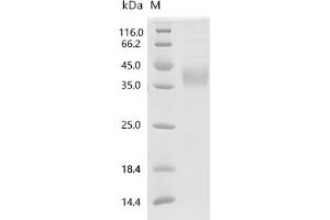 (Tris-Glycine gel) Discontinuous SDS-PAGE (reduced) with 5 % enrichment gel and 15 % separation gel.