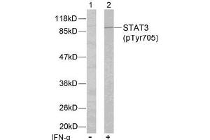 Image no. 2 for anti-Signal Transducer and Activator of Transcription 3 (Acute-Phase Response Factor) (STAT3) (pTyr705) antibody (ABIN196691) (STAT3 Antikörper  (pTyr705))