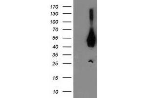 Western Blotting (WB) image for anti-Activating Signal Cointegrator 1 Complex Subunit 1 (ASCC1) antibody (ABIN1496743) (ASCC1 Antikörper)