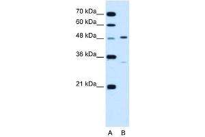 CHST1 antibody used at 1. (CHST1 Antikörper)