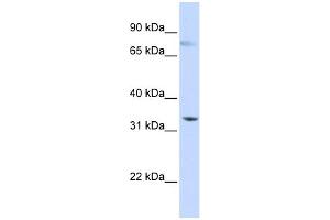 WB Suggested Anti-SIGLEC6 Antibody Titration:  0. (SIGLEC6 Antikörper  (N-Term))