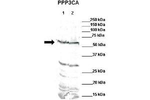 Western Blotting (WB) image for anti-Protein Phosphatase 3, Catalytic Subunit, alpha Isoform (PPP3CA) (N-Term) antibody (ABIN2784523)