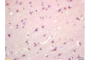 Immunohistochemistry (IHC) image for anti-Solute Carrier Family 7, (Cationic Amino Acid Transporter, Y+ System) Member 11 (SLC7A11) (AA 201-300) antibody (ABIN872924)