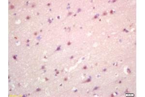 Formalin-fixed and paraffin embedded human brain labeled with Anti-CCBR1 Polyclonal Antibody, Unconjugated (ABIN872924) at 1:200 followed by conjugation to the secondary antibody and DAB staining (SLC7A11 Antikörper  (AA 201-300))