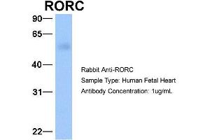 Host: Rabbit Target Name: RORC Sample Type: Human Fetal Heart Antibody Dilution: 1. (RORC Antikörper  (C-Term))