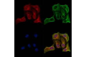 ABIN7094754 and ABIN7098805 staining Hela cells by IF/ICC. (GPAT2 Antikörper  (Internal Region))