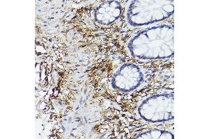 Immunohistochemistry of paraffin-embedded human colon using CD90/Thy1 Rabbit mAb (ABIN6129735, ABIN6148554, ABIN6148555 and ABIN7101405) at dilution of 1:100 (40x lens). (CD90 Antikörper)