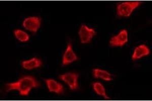 ABIN6278605 staining Hela by IF/ICC. (OR2A5/2A14 Antikörper)