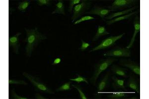 Immunofluorescence of monoclonal antibody to ZIC3 on HeLa cell. (ZIC3 Antikörper  (AA 182-274))