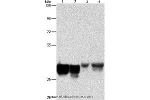 Western blot analysis of Hela and 293T cell, mouse liver tissue and NIH/3T3 cell, using AUP1 Polyclonal Antibody at dilution of 1:500 (Ancient Ubiquitous Protein 1 Antikörper)