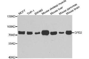 Western blot analysis of extracts of various cell lines, using GPD2 antibody. (GPD2 Antikörper  (AA 25-325))