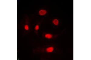 Immunofluorescent analysis of TRA2A staining in HeLa cells. (TRA2A Antikörper  (C-Term))