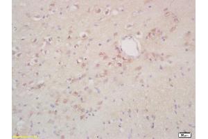 Formalin-fixed and paraffin embedded rat brain labeled with Rabbit Anti phospho-NIFK/MKI67IP(Thr234) Polyclonal Antibody, Unconjugated (ABIN872293) at 1:200 followed by conjugation to the secondary antibody and DAB staining