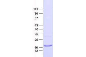 Western Blotting (WB) image for FUN14 Domain Containing 1 (FUNDC1) protein (His tag) (ABIN2721459)