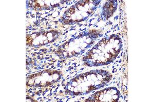 Immunohistochemistry of paraffin-embedded Human colon using FGF2 Rabbit pAb (ABIN3020744, ABIN3020745, ABIN3020746 and ABIN6213702) at dilution of 1:100 (40x lens). (FGF2 Antikörper  (AA 143-288))