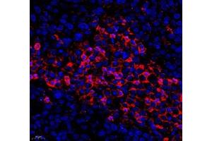 Immunofluorescence of paraffin embedded human ovarian cancer using KCTD19 (ABIN7075147) at dilution of 1: 500 (400x lens) (KCTD19 Antikörper)