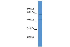 ACADVL antibody used at 0. (ACADVL Antikörper  (C-Term))