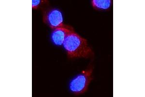 IF analysis of ACVR2A using anti-ACVR2A antibody (ABIN4886422).