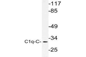 Western blot (WB) analysis of C1q-C antibody in extracts from rat lung cells. (C1QC Antikörper)