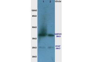 SDS-PAGE (SDS) image for anti-Vascular Endothelial Growth Factor (VEGF) antibody (ABIN674829)