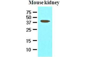 Western Blotting (WB) image for anti-Apoptosis, Caspase Activation Inhibitor (AVEN) (AA 254-362) antibody (ABIN336089) (AVEN Antikörper  (AA 254-362))