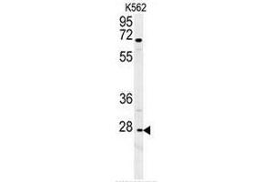 CXCR3 Antibody (Center) western blot analysis in K562 cell line lysates (35µg/lane). (CXCR3 Antikörper  (Middle Region))