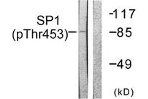 Western blot analysis of extracts from A549 cells, using SP1 (Phospho-Thr453) Antibody. (SP1 Antikörper  (pThr453))