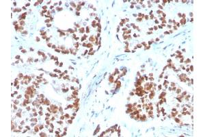 Immunohistochemistry (IHC) image for anti-NK3 Homeobox 1 (NKX3-1) (AA 92-224) antibody (ABIN6940208)