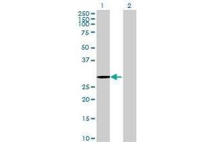 Western Blotting (WB) image for PCSK1N 293T Cell Transient Overexpression Lysate(Denatured) (ABIN1336033)