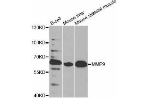 Western blot analysis of extracts of various cell lines, using MMP9 antibody. (MMP 9 Antikörper)