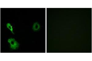 Immunofluorescence analysis of A549 cells, using GRM7 Antibody.