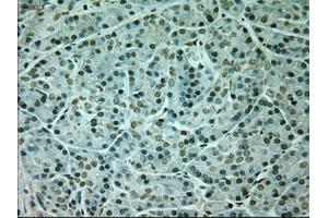 Immunohistochemical staining of paraffin-embedded Kidney tissue using anti-NEUROG1mouse monoclonal antibody. (Neurogenin 1 Antikörper)