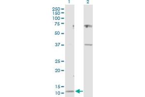 Western Blot analysis of CST3 expression in transfected 293T cell line by CST3 MaxPab polyclonal antibody. (CST3 Antikörper  (AA 1-146))