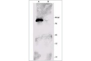 Image no. 1 for anti-Ribosomal Protein S6 Kinase, 90kDa, Polypeptide 1 (RPS6KA1) (C-Term) antibody (ABIN264872) (RPS6KA1 Antikörper  (C-Term))