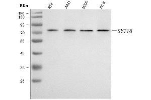 Western blot analysis of SYT16 using anti-SYT16 antibody (ABIN7599425).