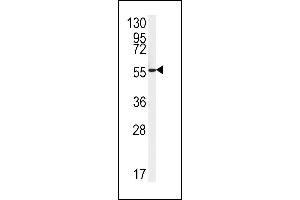 Western blot analysis of FH2 Antibody (C-term) (ABIN651343 and ABIN2840194) in HepG2 cell line lysates (35 μg/lane). (FAAH2 Antikörper  (C-Term))