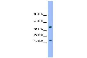 GABARAP antibody used at 0. (GABARAP Antikörper  (C-Term))