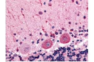 Immunohistochemical staining of human brain (Purkinje Neurons) using anti-CELSR3 antibody (CELSR3 Antikörper  (C-Term))