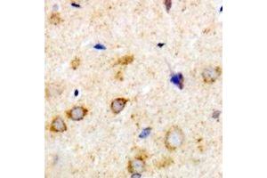 Immunohistochemical analysis of Rabphilin 3A staining in human brain formalin fixed paraffin embedded tissue section. (RPH3A Antikörper)