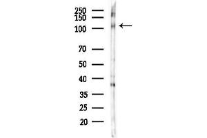 Western blot analysis of lysates from B16F10-LUC cells(UV,30 min treatment), using Phospho-PSD95 (Thr19) Antibody at 1/1000 dilution.