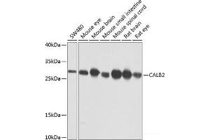 Western blot analysis of extracts of various cell lines using CALB2 Polyclonal Antibody at dilution of 1:1000.