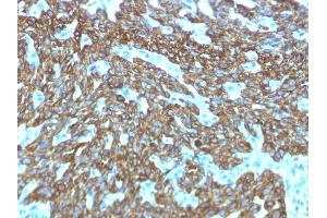 Formalin-fixed, paraffin-embedded human Skin stained with Cytokeratin, HMW Rabbit Recombinant Monoclonal Antibody (KRTH/1576R).
