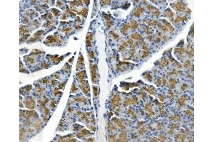IHC analysis of Gp2 using anti-Gp2 antibody (ABIN7601427). (GP2 Antikörper  (AA 35-497))