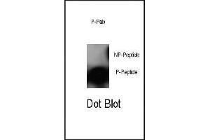Dot blot analysis of anti-Phospho-cJun-S63 Antibody (ABIN389544 and ABIN2839589) on nitrocellulose membrane. (C-JUN Antikörper  (pSer63))