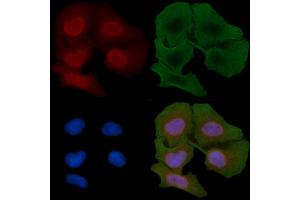 ABIN6259872 and ABIN6266829 staining Hela cells(30 min of UV treatment) by IF/ICC. (Cyclin-Dependent Kinase 15 (ALS2CR7) (Internal Region) Antikörper)